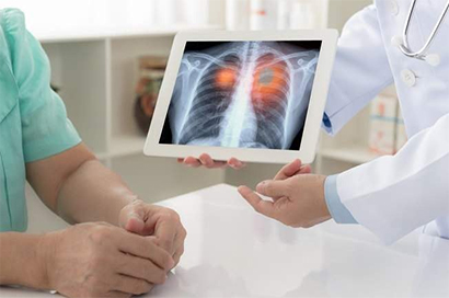 Inteligência artificial auxilia médicos no diagnóstico de Covid-19